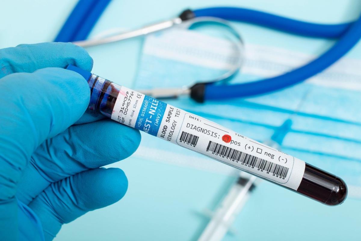 Ruka u rukavici drži epruvetu sa uzorkom krvi i nalepnicom za test na virus Zapadnog Nila